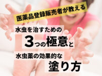効果的な水虫薬の塗り方！登録販売者が教える水虫を治す3つの極意